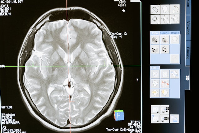 traumatic brain injury