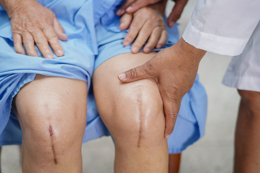 patient scarred knees